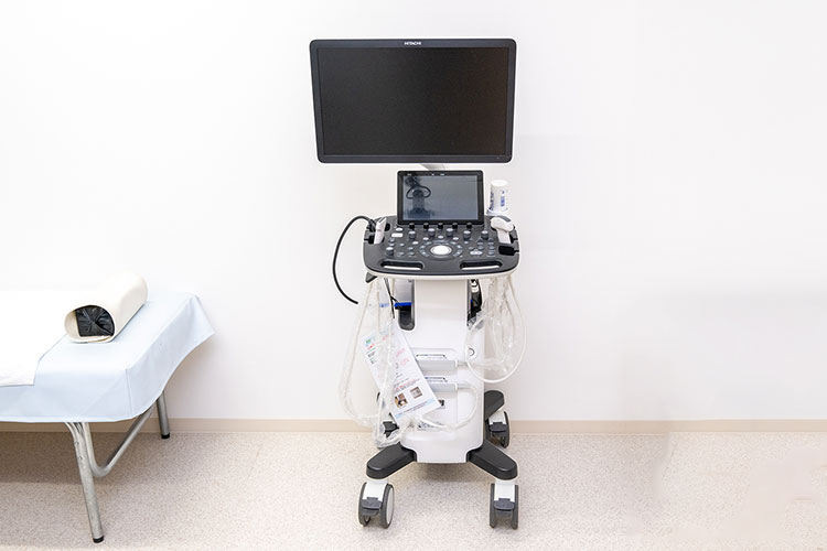 超音波診断装置